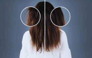 Fix Damaged Hair