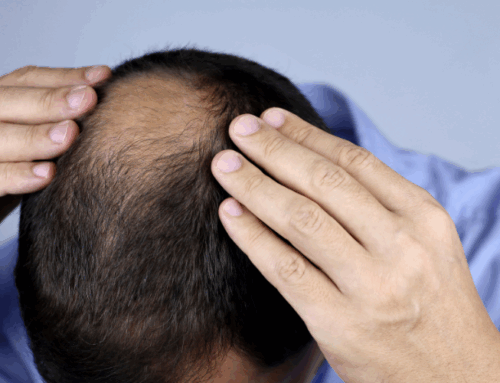 How to Prevent Hair Loss: Expert Advice for Men, Women, Post-Pregnancy, Chemo, and At-Home Solutions